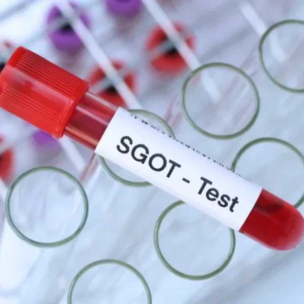 AST- SGOT- GOT