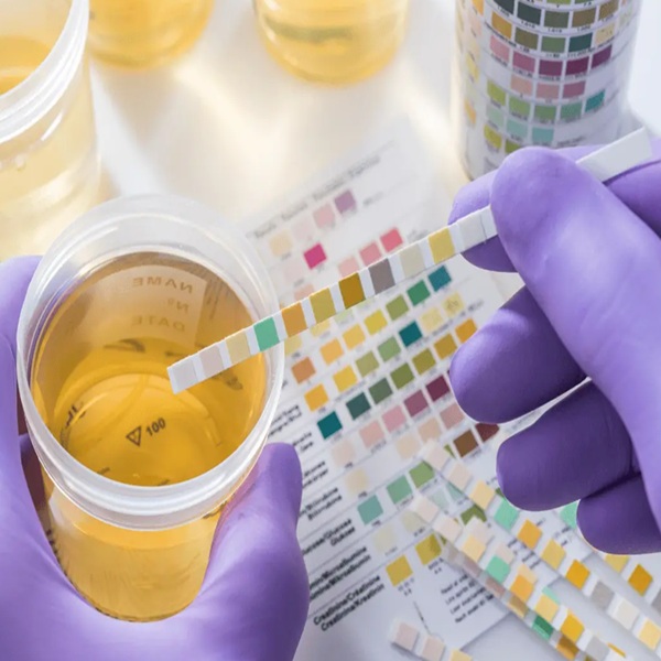UA. Urine