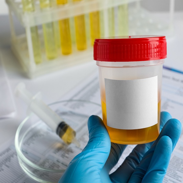 Urine Culture