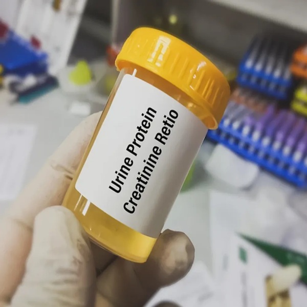 Cr Urine