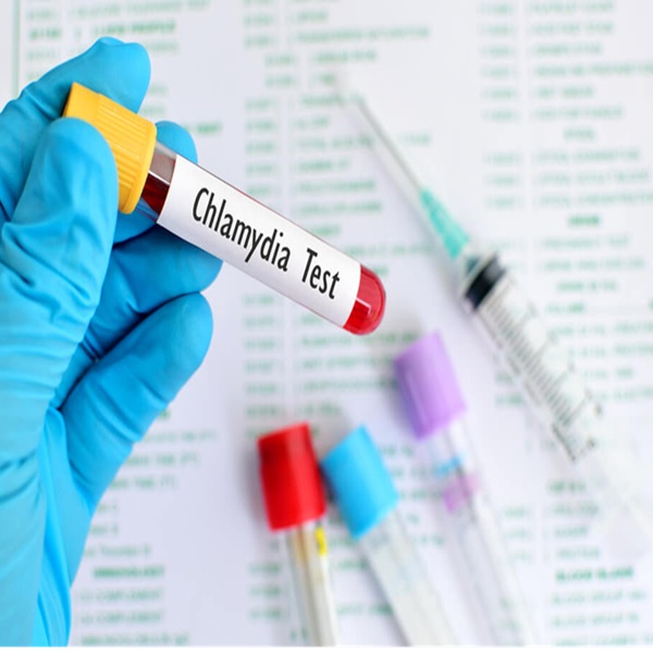 Chlamydia IgG/IgM