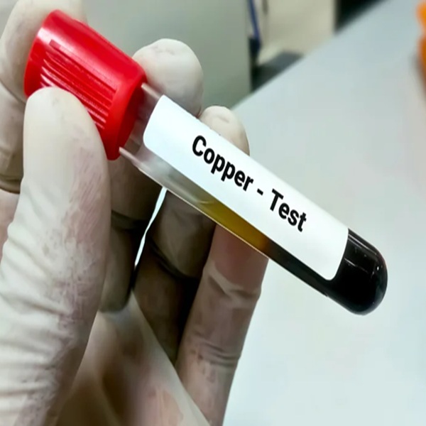 Cu