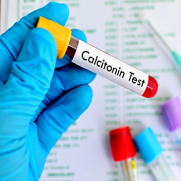 (Calcitonin (HCT